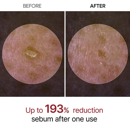 Dr.Melaxin Peel Shot Glow Black And White Rice Ampoule